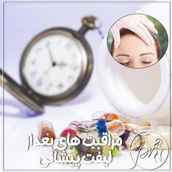مراقبت های بعد از لیفت پیشانی - دکتر پریا روانفر
