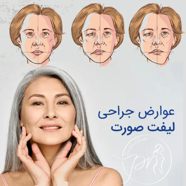 عوارض لیفت صورت - دکتر پریا روانفر