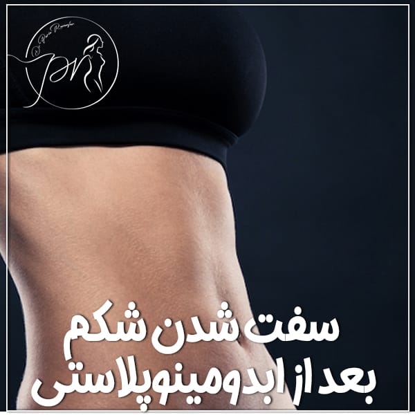 سفت شدن شکم بعد از ابدومینوپلاستی - دکتر پریا روانفر