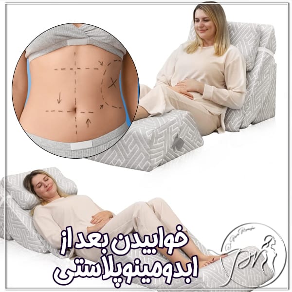 خوابیدن بعد از ابدومینوپلاستی - دکتر پریا روانفر