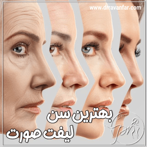 سن مناسب لیفت صورت - دکتر پریا روانفر