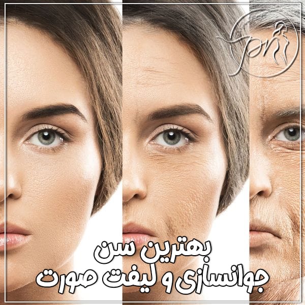 بهترین سن لیفت و جوانسازی صورت - دکتر پریا روانفر