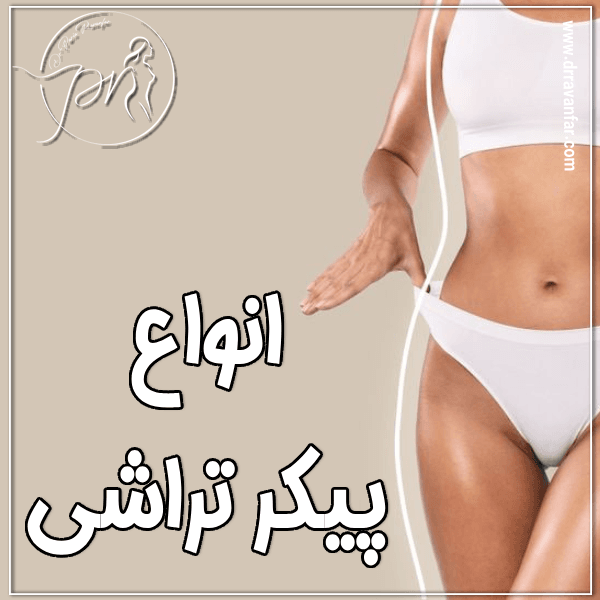 انواع پیکرتراشی - دکتر پریا روانفر