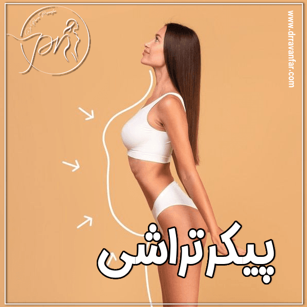 پیکرتراشی - دکتر پریا روانفر