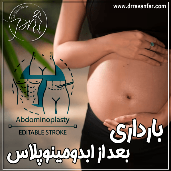 بارداری بعد از ابدو مینو پلاستی - دکتر پریا روانفر