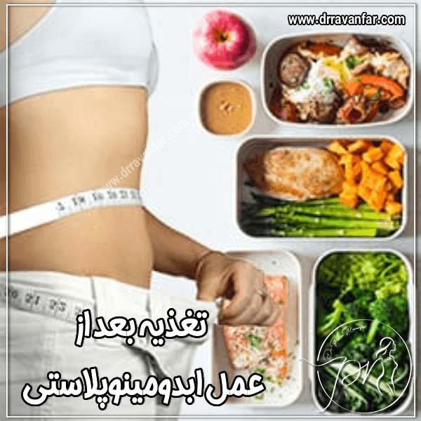 تغذیه بعد از ابدومینوپلاستی - دکتر پریا روانفر